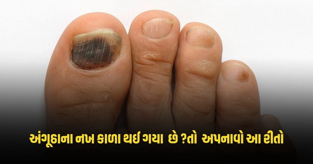 Nail Care Tips: અંગૂઠાના નખ કાળા થઈ ગયા હોય તો તેને સાફ કરવા માટે અપનાવો આ રીતો https://www.pravinews.com/sports/ipl-2024/ipl-2024-ruturaj-gaikwads-historic-century-becomes-the-first-captain-to-do-so-for-csk-4421