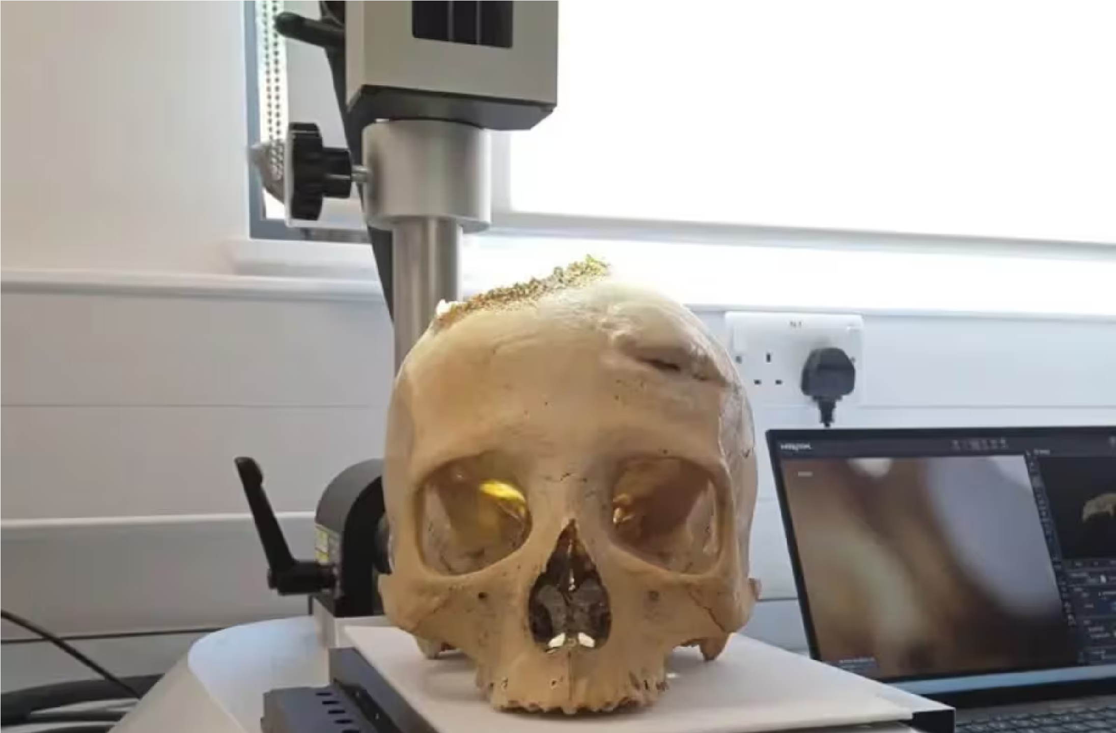 Ajab Gajab : આટલા વર્ષો જૂની ખોપડીમાંથી ખુલ્યા એવા રહસ્યો કે ચોંકી ગયા વૈજ્ઞાનિકો, સદીઓ પહેલા પણ થતું હતું આવું કામ https://www.pravinews.com/ajab-gajab/scientist-shocked-after-found-evidence-of-ancient-egyptians-tried-to-treat-brain-cancer-more-than-4000-years-ago-9993