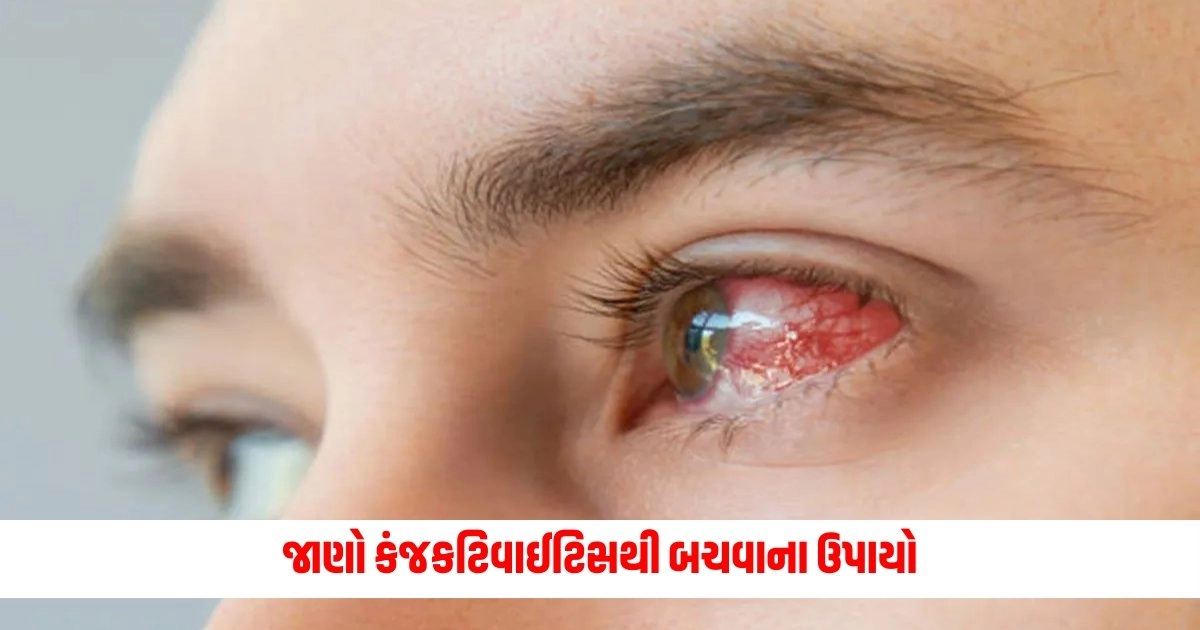 Conjunctivitis: વરસાદની મોસમમાં તમારી આંખોની રાખો સંભાળ, જાણો કંજકટિવાઈટિસથી બચવાના ઉપાયો https://www.pravinews.com/religion/astrology/rare-dwipushkar-yoga-and-5-auspicious-combinations-to-receive-maa-parvati-blessings-on-mangala-gauri-vrat-18503