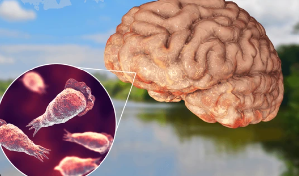 Brain Eating Amoeba: દેશમાં અમીબાનો ચેપ વધ્યો, અત્યાર સુધીમાં 22 લોકોના થયા મોત 3 Brain Eating Amoeba: દેશમાં અમીબાનો ચેપ વધ્યો, અત્યાર સુધીમાં 22 લોકોના થયા મોત https://www.pravinews.com/world-news-in-gujarati/danger-infection-of-brain-eating-amoeba-increased-in-the-country-22-people-have-died-so-far-17769