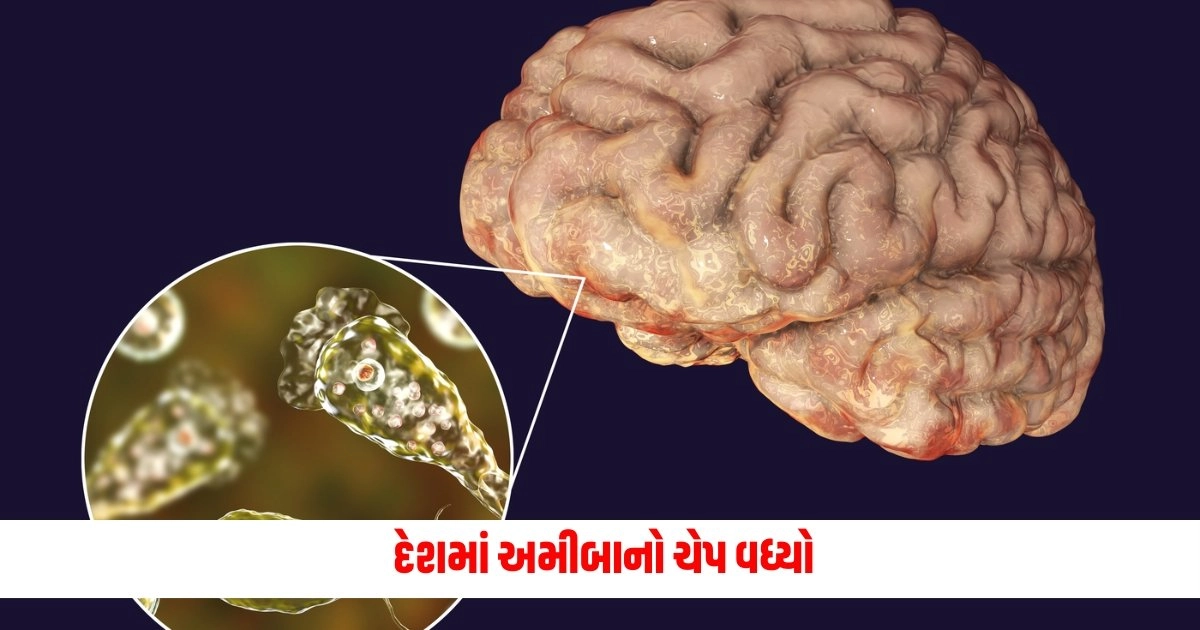 Brain Eating Amoeba: દેશમાં અમીબાનો ચેપ વધ્યો, અત્યાર સુધીમાં 22 લોકોના થયા મોત https://www.pravinews.com/world-news-in-gujarati/water-board-scam-ed-raids-in-delhi-mumbai-ahmedabad-and-hyderabad-41-lakh-cash-and-documents-seized-17768