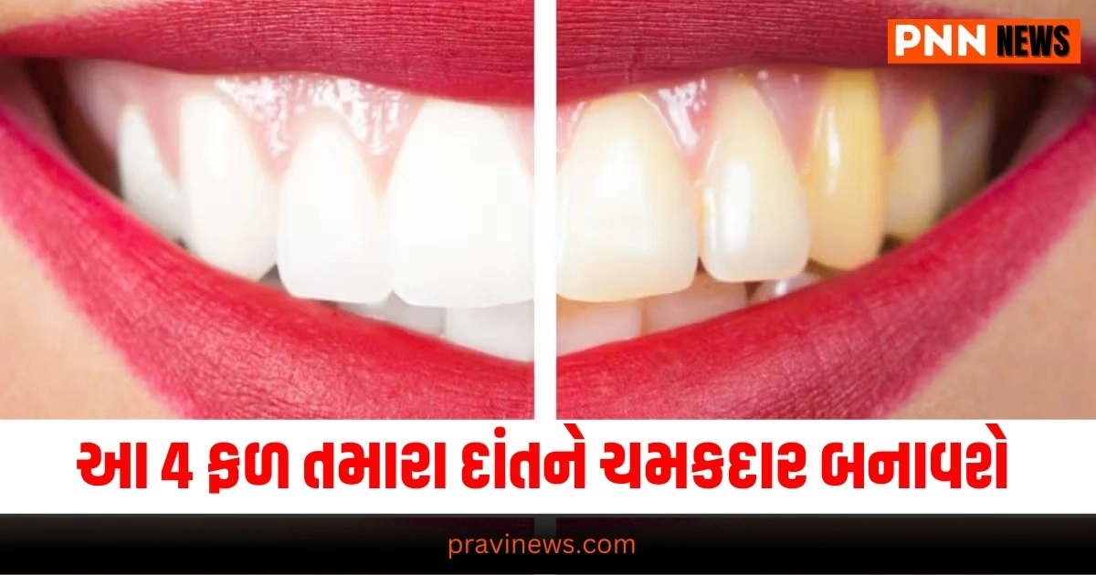 White Teeth, Latest Health News, Live Health Update, Health Update, Health News, Health Headline, Today’s Health Update, Current Health News,