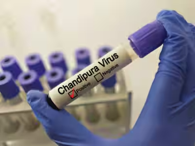 Chandipura Virus: ચાંદીપુરા વાયરસને કારણે રાજ્યમાં 73ના મોત, 12 દિવસમાં કોઈએ જીવ ગુમાવ્યા નથી https://www.pravinews.com/gujarat-news/73-people-died-in-the-state-due-to-chandipura-virus-no-one-lost-their-life-in-12-days-31189