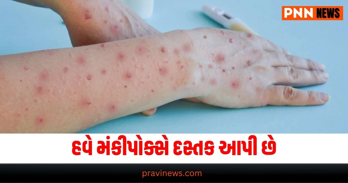 Monkeypox : COVID-19 પછી, હવે મંકીપોક્સે દસ્તક આપી છે, ભારતે સુરક્ષા વધારી https://www.pravinews.com/religion/astrology/harchath-vrat-2024-date-24-august-know-what-to-eat-shubh-muhurat-and-hal-shashthi-vrat-katha-31722