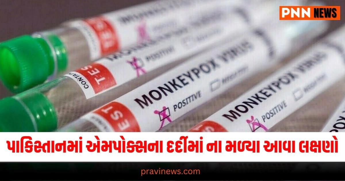 gujarati news","Latest News Updates","monkeypox","gujarati  samachar","pakistan","WHO",  "Latest News Updates  of monkeypox, top update of monkeypox, Pakistan  monkeypox Update,