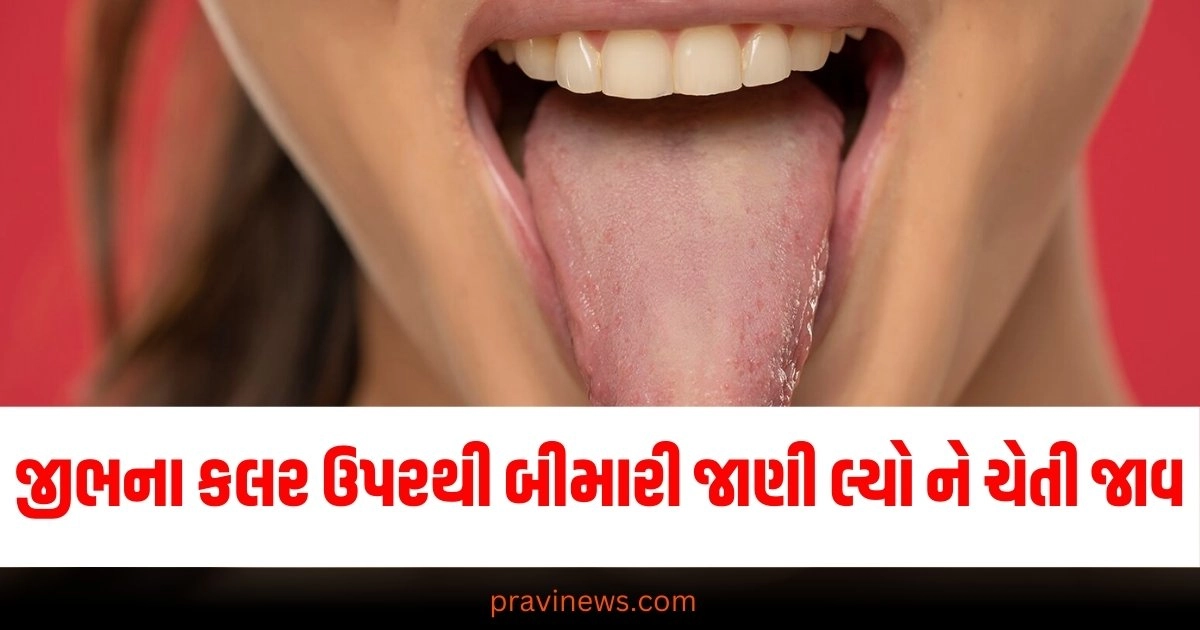 Cancer, Health Issue, Tongue Color, Gujarati news, latest Gujarati news, latest news in Gujarati, breaking news in Gujarati,