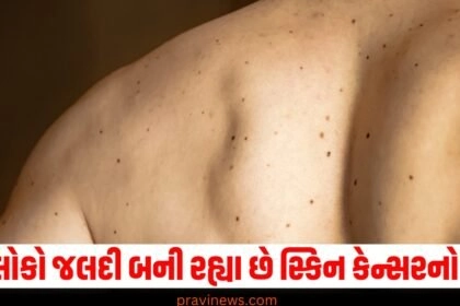 Skin Cancer Symptoms and Treatment,Skin Cancer ,Symptoms and Treatment,Cancer ,Breaking News, Gujarat latest News,"Deaths ,skin cancer,victims ,sunburn"