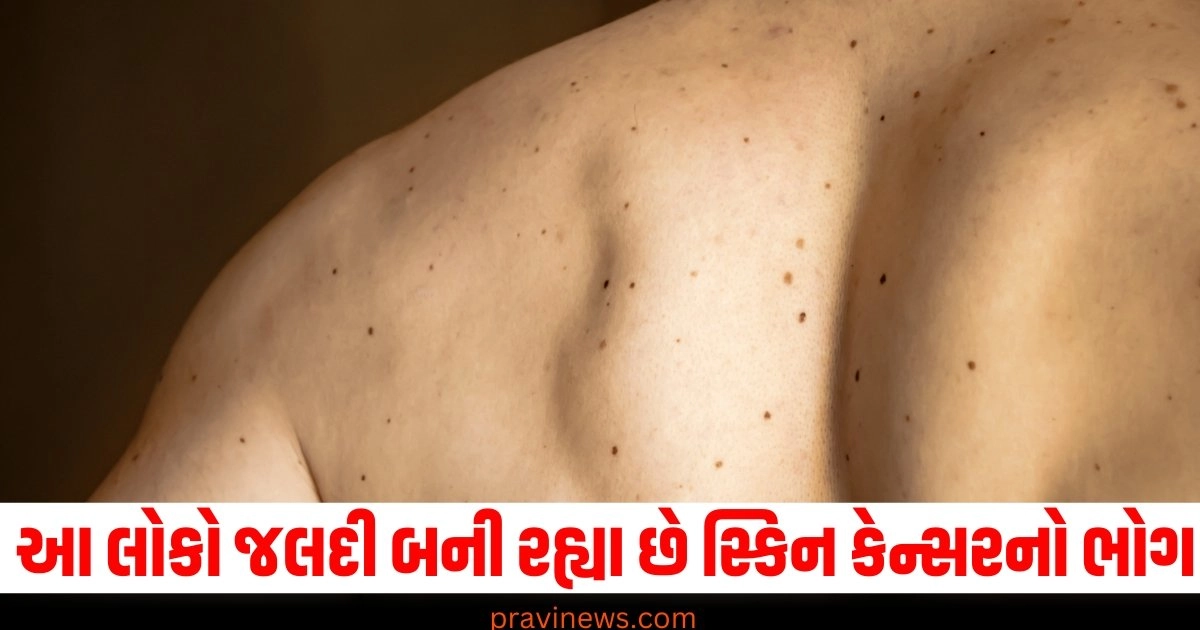 Skin Cancer Symptoms and Treatment,Skin Cancer ,Symptoms and Treatment,Cancer ,Breaking News, Gujarat latest News,"Deaths ,skin cancer,victims ,sunburn"