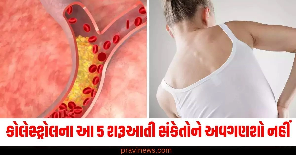 કોલેસ્ટ્રોલના આ 5 શરૂઆતી સંકેતોને અવગણશો નહીં, જાણો લક્ષણો અને નિવારણ https://www.pravinews.com/lifestyle/health-fitness/bad-cholesterol-causes-reasons-signs-symptoms-prevention-tips-health-news-51923