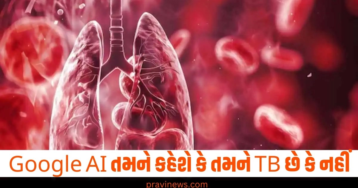 Google AI, TB (ટીબીએચ), બીમારીઓ, મદદ, તંત્ર, તકનીકી,