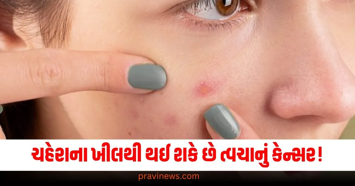 ચહેરાના ખીલને અવગણશો નહીં, તેનાથી થઈ શકે છે ત્વચાનું કેન્સર! https://www.pravinews.com/ajab-gajab/what-pakistan-people-search-most-about-india-in-google-2024-know-about-searches-people-and-news-68526