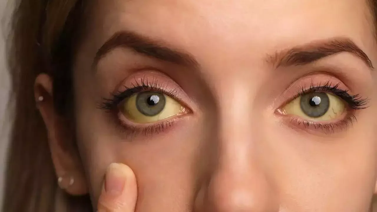 વિટામિન B-12 ની ઉણપથી થાય છે આ 3 ગંભીર બીમારીઓ! જાણો તેના શરૂઆતના સંકેતો 3 વિટામિન B-12 ની ઉણપથી થાય છે આ 3 ગંભીર બીમારીઓ! જાણો તેના શરૂઆતના સંકેતો https://www.pravinews.com/lifestyle/health-fitness/vitamin-b-12-deficiency-symptoms-signs-disease-anemia-mental-health-eyes-problems-sanket-lakshan-kya-khane-se-badhega-74576