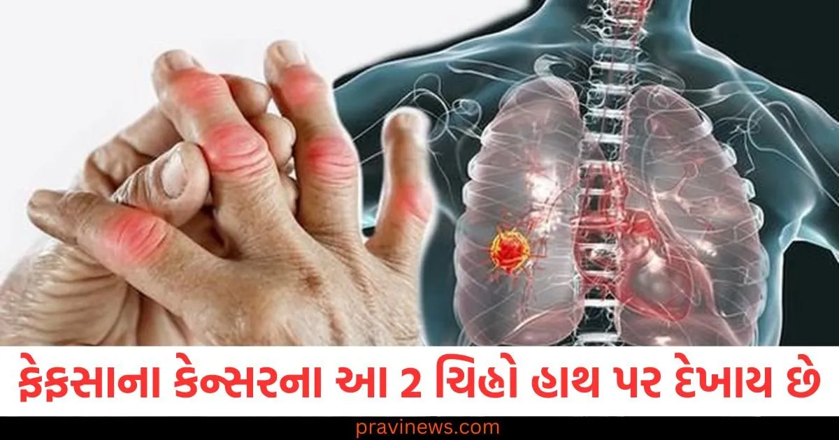 ફેફસાના કેન્સરના આ 2 ચિહ્નો હાથ પર દેખાય છે, જાણો તેનું નિવારણ https://www.pravinews.com/lifestyle/healthy-sleep-early-bedtime-hormonal-regulation-healthy-metabolism-digestion-health-tips-83603