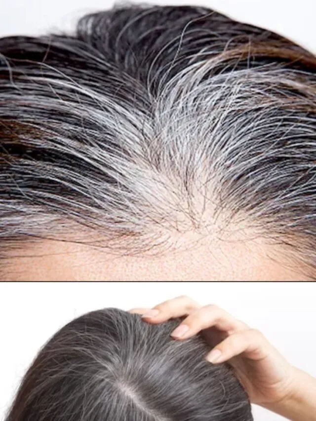 સફેદ વાળને કાળા કરવા માટે આ ઘરેલુ વસ્તુઓનો ઉપયોગ કરો