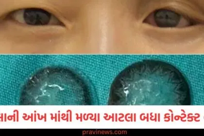 અરે બાપરે... આ શું? ડોક્ટરોને એક મહિલાની આંખ પાછળ ખોવાઈ ગયેલા આટલા બધા કોન્ટેક્ટ લેન્સ મળ્યા https://www.pravinews.com/trending